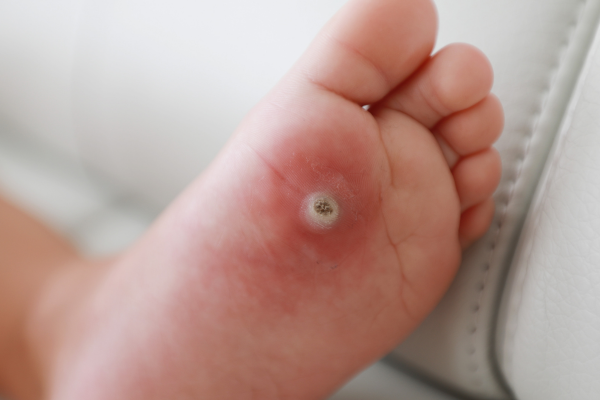 Comprehensive Foot Evaluation