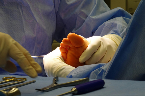 Endovascular Procedures