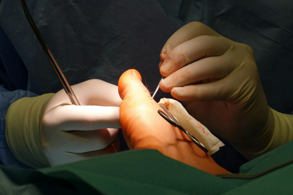 Nerve & Tendon Surgery