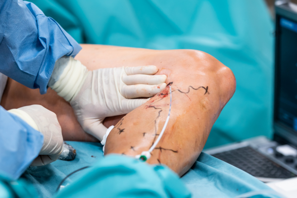 Vascular Assessment