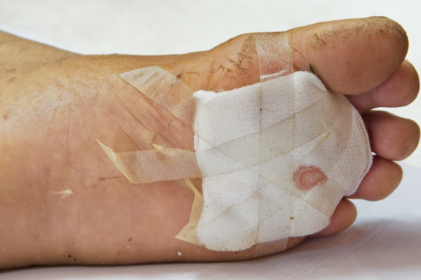 Wound Reconstruction